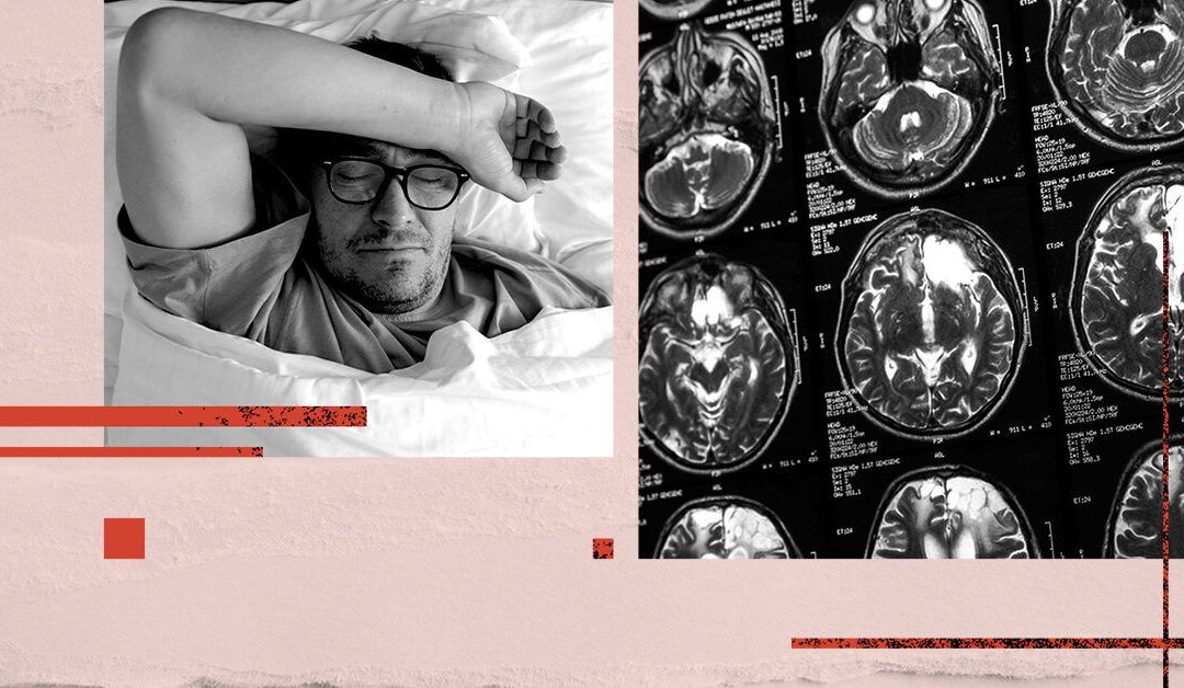 Sleep quality may increase dementia risk: Latest evidence