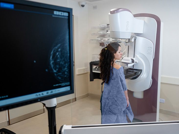 AI-assisted mammograms could cut risk of developing aggressive breast cancer