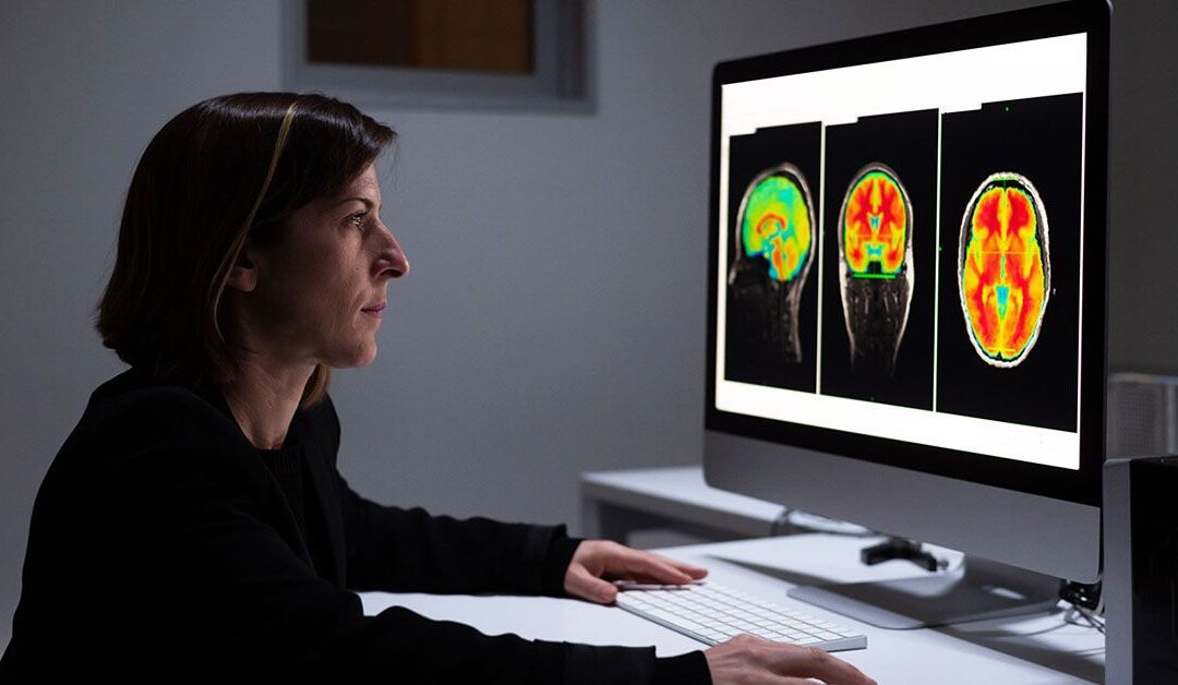 AI tool predicts Alzheimer’s disease with nearly 93% accuracy using brain scans