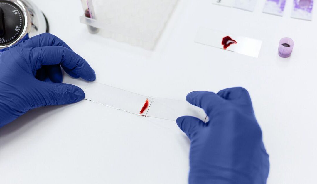 Blood test may predict dementia up to 25 years before symptom onset in women