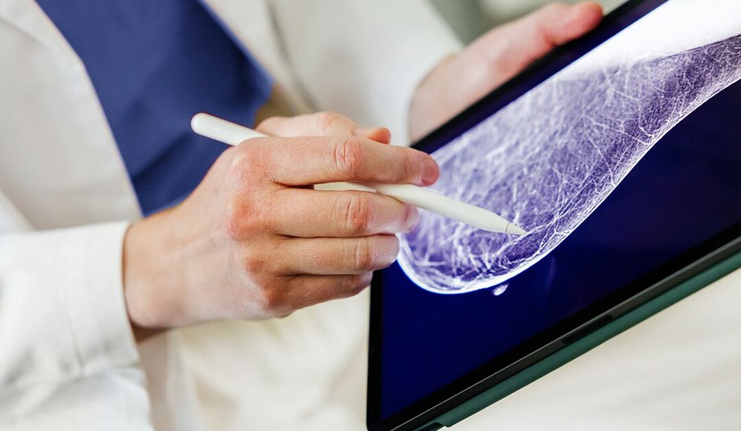 Routine mammograms may help predict heart disease, study suggests