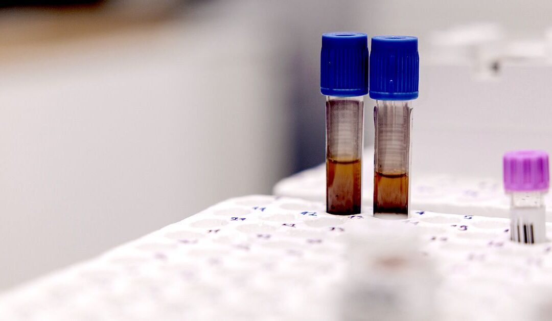 Could anemia increase the risk of developing dementia?