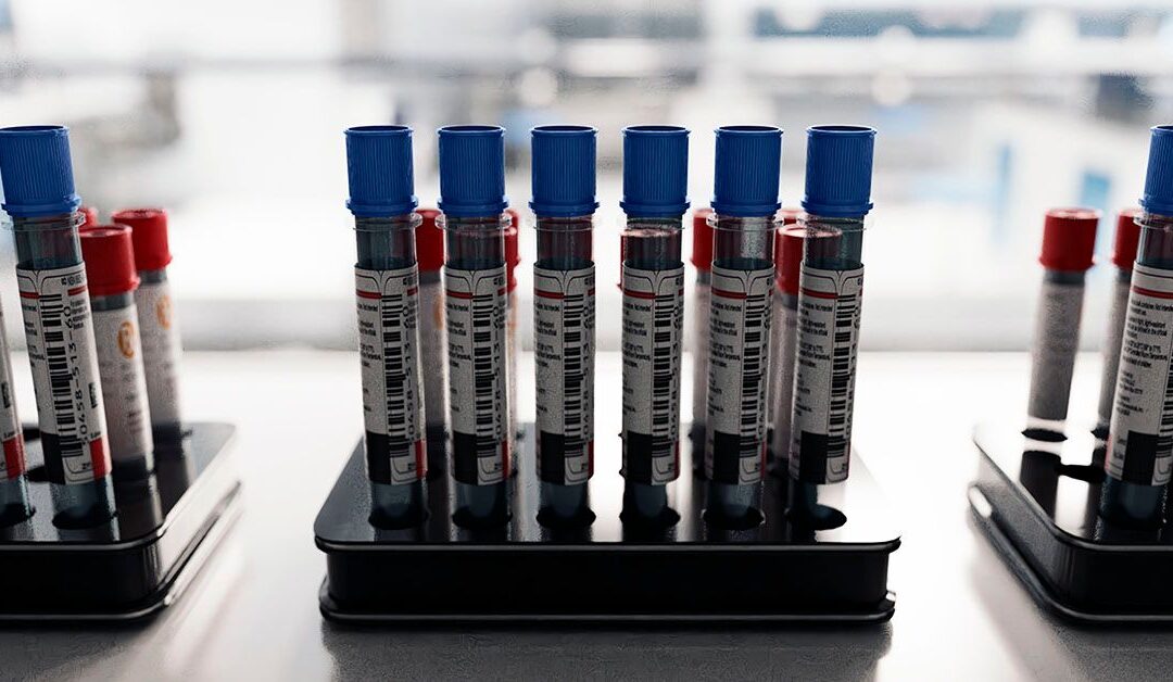 Blood test may be more effective and cost-efficient than standard cholesterol tests