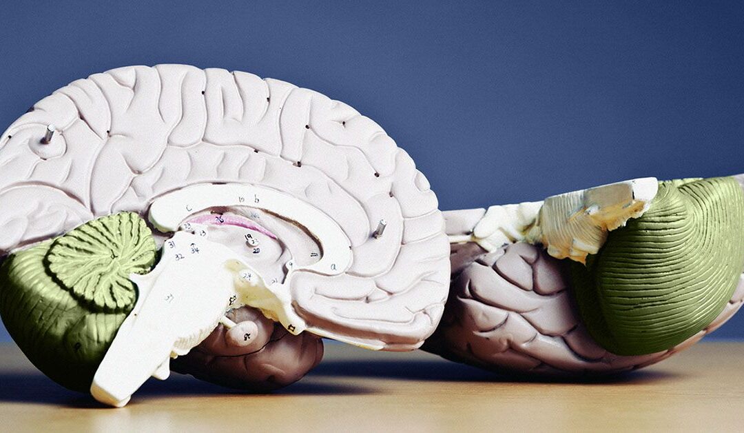 AHA identifies 10 key factors to lower dementia and stroke risk