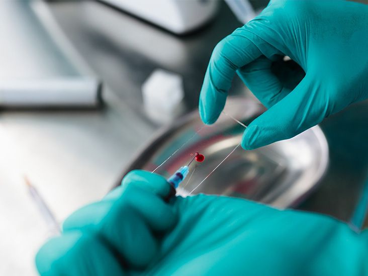 New colorectal cancer screening guidelines add blood and at-home stool tests