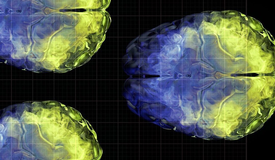 Vitamin C may help preserve brain gray matter volume as we age