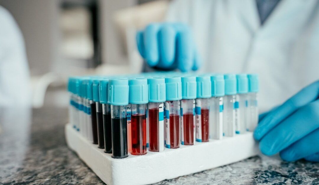 Alzheimer’s blood test could identify risk up to 10 years before symptoms start
