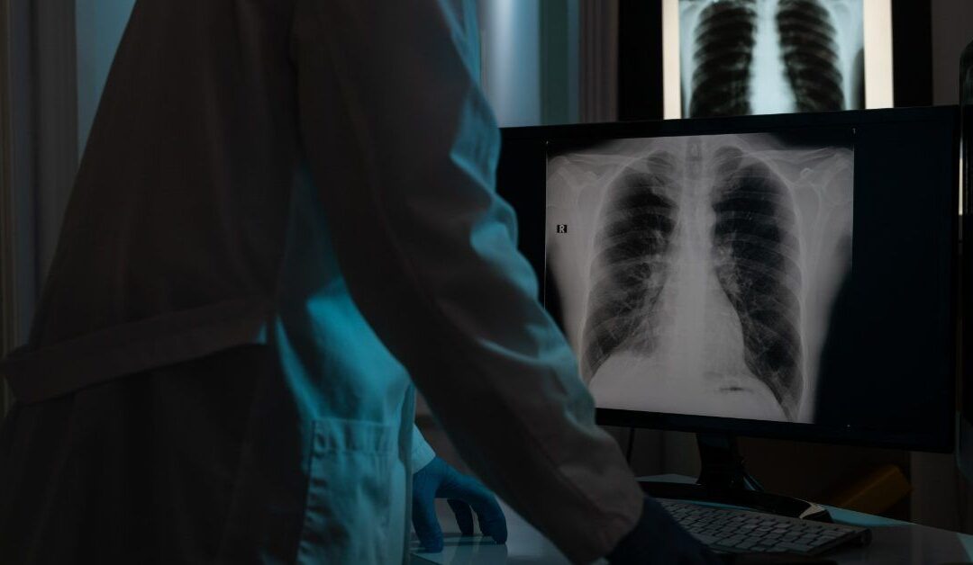 Pancreatic cancer drug may also help fight treatment-resistant lung cancer