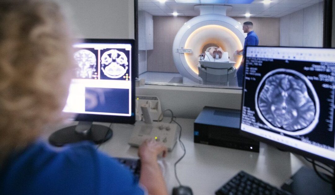 AI complements radiologists to help improve brain aneurysm detection