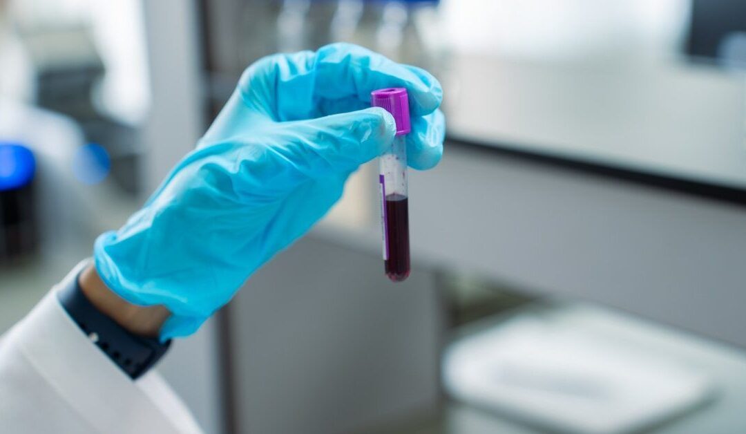 AI-enhanced biomarker blood test may detect pancreatic cancer earlier, study suggests
