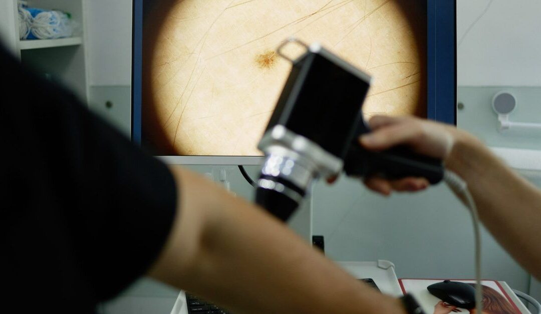 Skin cancer checks: What AI can help catch — and how to check yourself at home